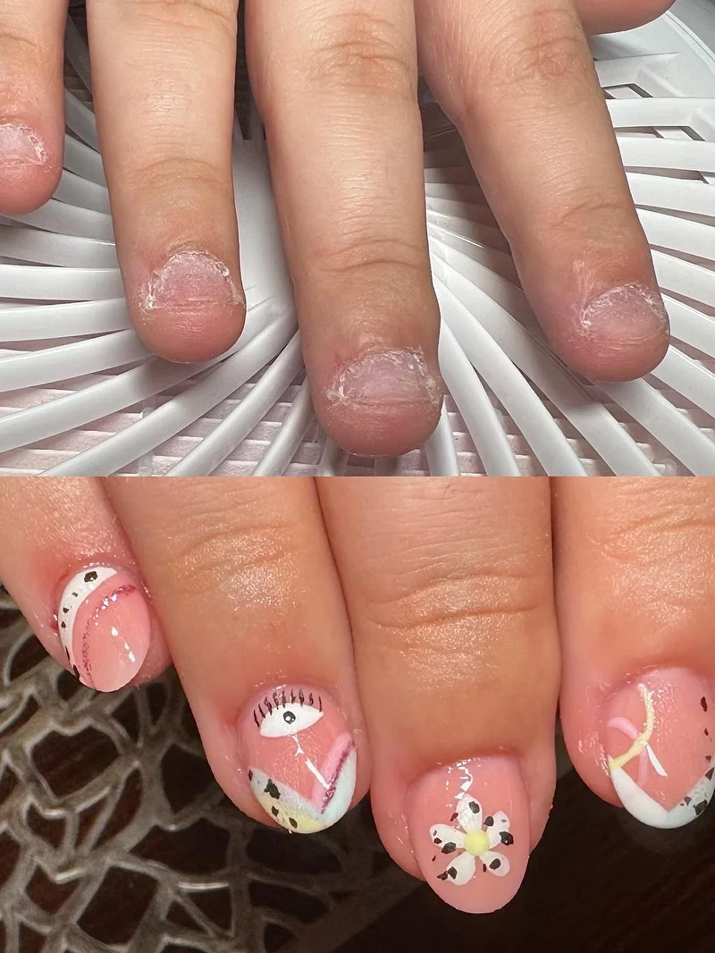 Bitten nails to nail art transformation before and after