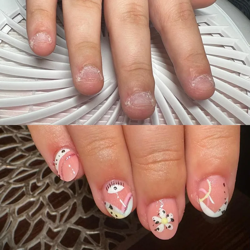Nail growth transformation before and after